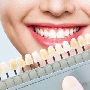 Teeth Whitening at Dental Care Associates